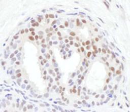 Detection of human Chk1, Phospho (S317) by immunohistochemistry.