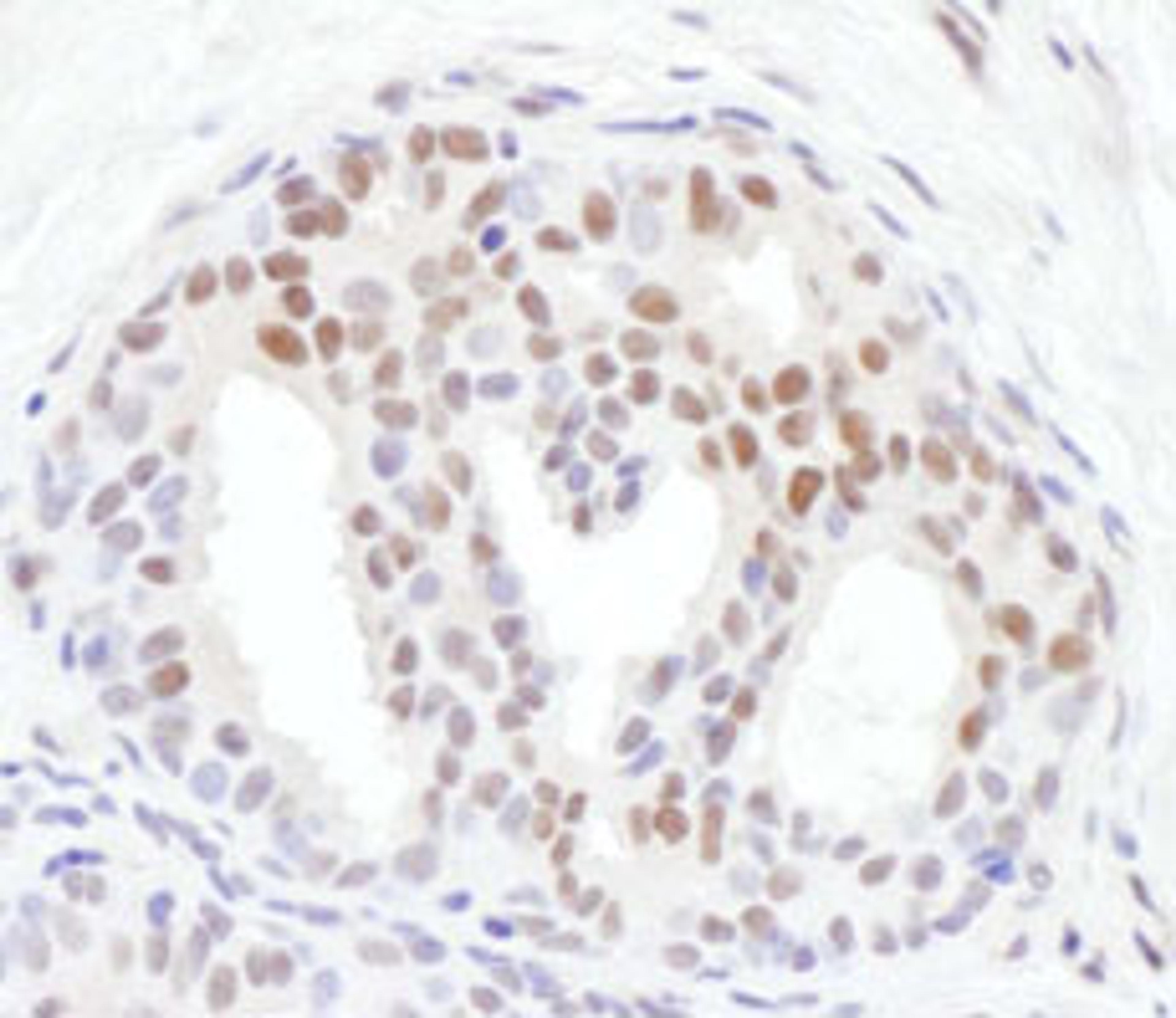 Detection of human Chk1, Phospho (S317) by immunohistochemistry.