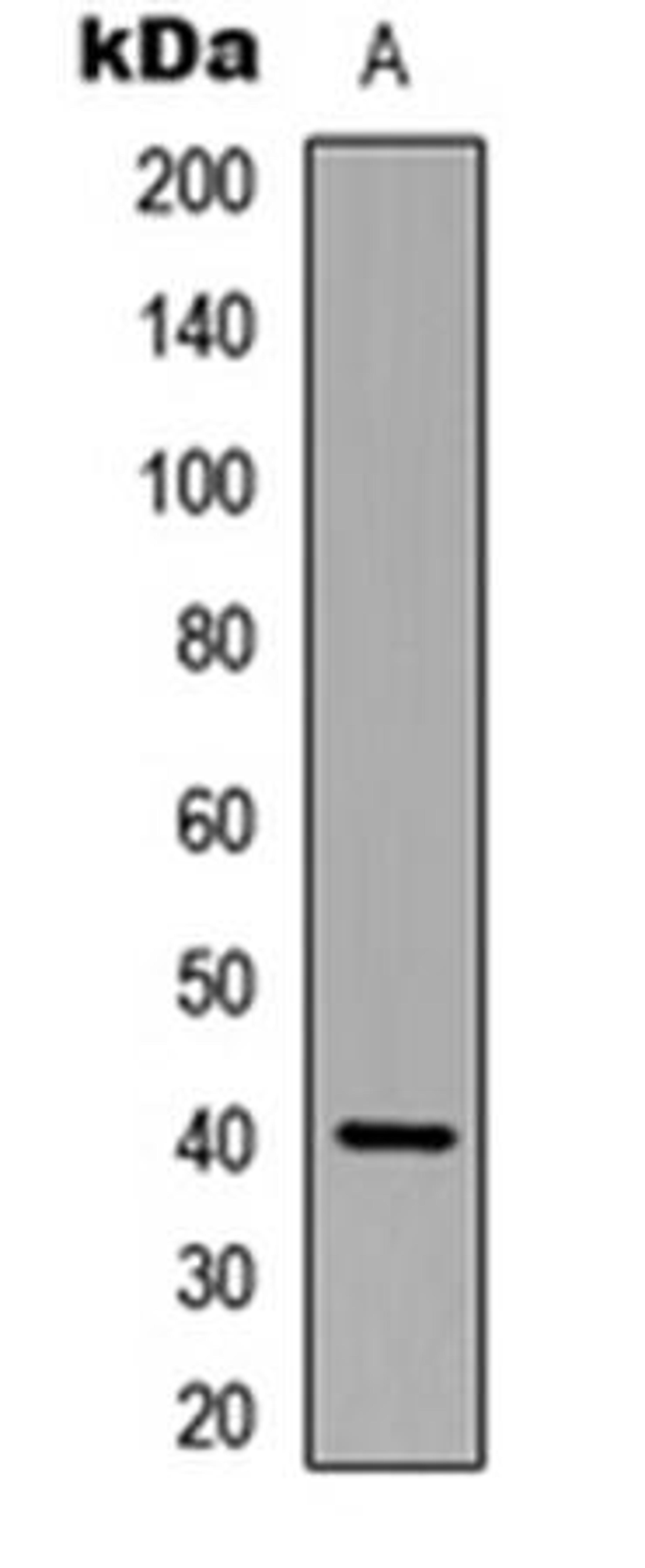 Western blot analysis of MCF7 (Lane1) whole cell using p40 phox antibody