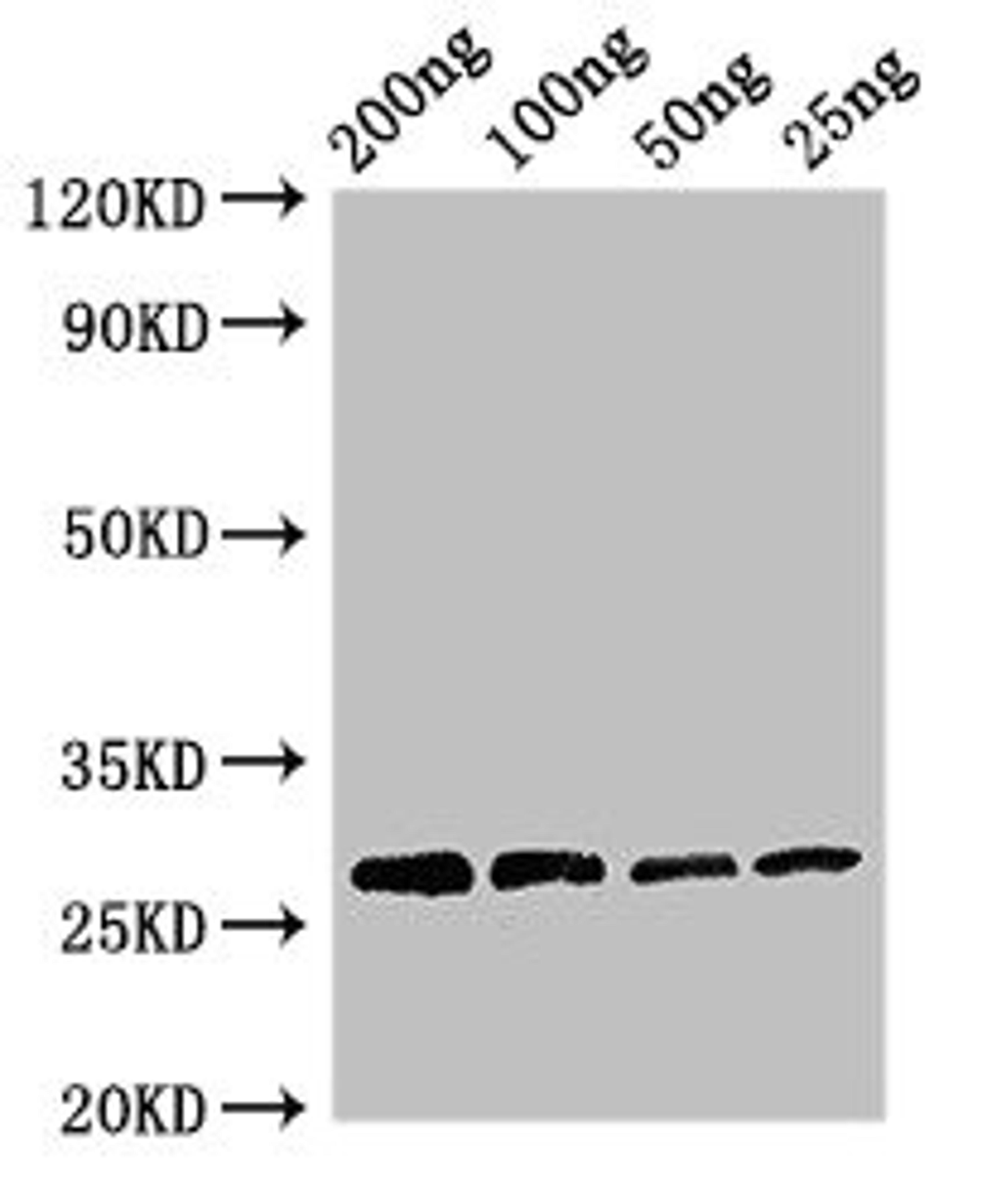 Western Blot. Positive WB detected in Recombinant protein. All lanes: Papain antibody at 3µg/ml. Secondary. Goat polyclonal to rabbit IgG at 1/50000 dilution. predicted band size: 27 kDa. observed band size: 27 kDa