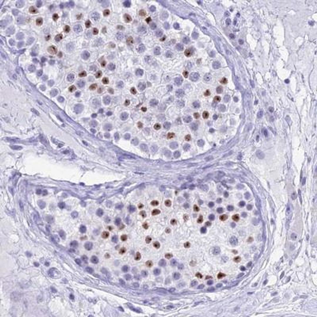 Immunohistochemistry: ZCCHC17 Antibody [NBP1-92605] - Staining of human testis shows moderate nucleolar positivity in subset of cells in seminiferus ducts.