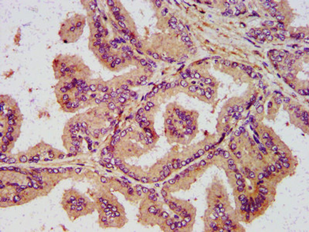 IHC image of CSB-PA859515LA01HU diluted at 1:400 and staining in paraffin-embedded human prostate tissue performed on a Leica BondTM system. After dewaxing and hydration, antigen retrieval was mediated by high pressure in a citrate buffer (pH 6.0). Section was blocked with 10% normal goat serum 30min at RT. Then primary antibody (1% BSA) was incubated at 4&deg;C overnight. The primary is detected by a biotinylated secondary antibody and visualized using an HRP conjugated SP system.