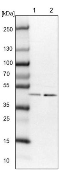 Western Blot: VPS37A Antibody [NBP1-83528] - Lane 1: NIH-3T3 cell lysate (Mouse embryonic fibroblast cells)<br/>Lane 2: NBT-II cell lysate (Rat Wistar bladder tumour cells)