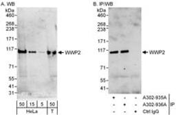 Detection of human WWP2 by western blot and immunoprecipitation.