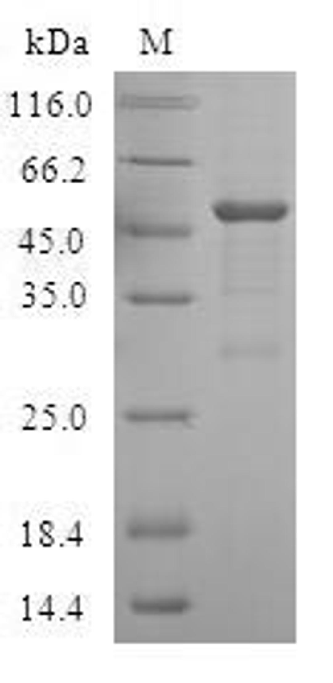 (Tris-Glycine gel) Discontinuous SDS-PAGE (reduced) with 5% enrichment gel and 15% separation gel.