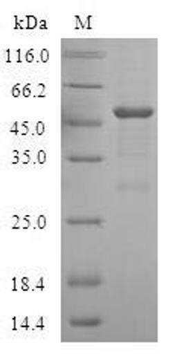 (Tris-Glycine gel) Discontinuous SDS-PAGE (reduced) with 5% enrichment gel and 15% separation gel.