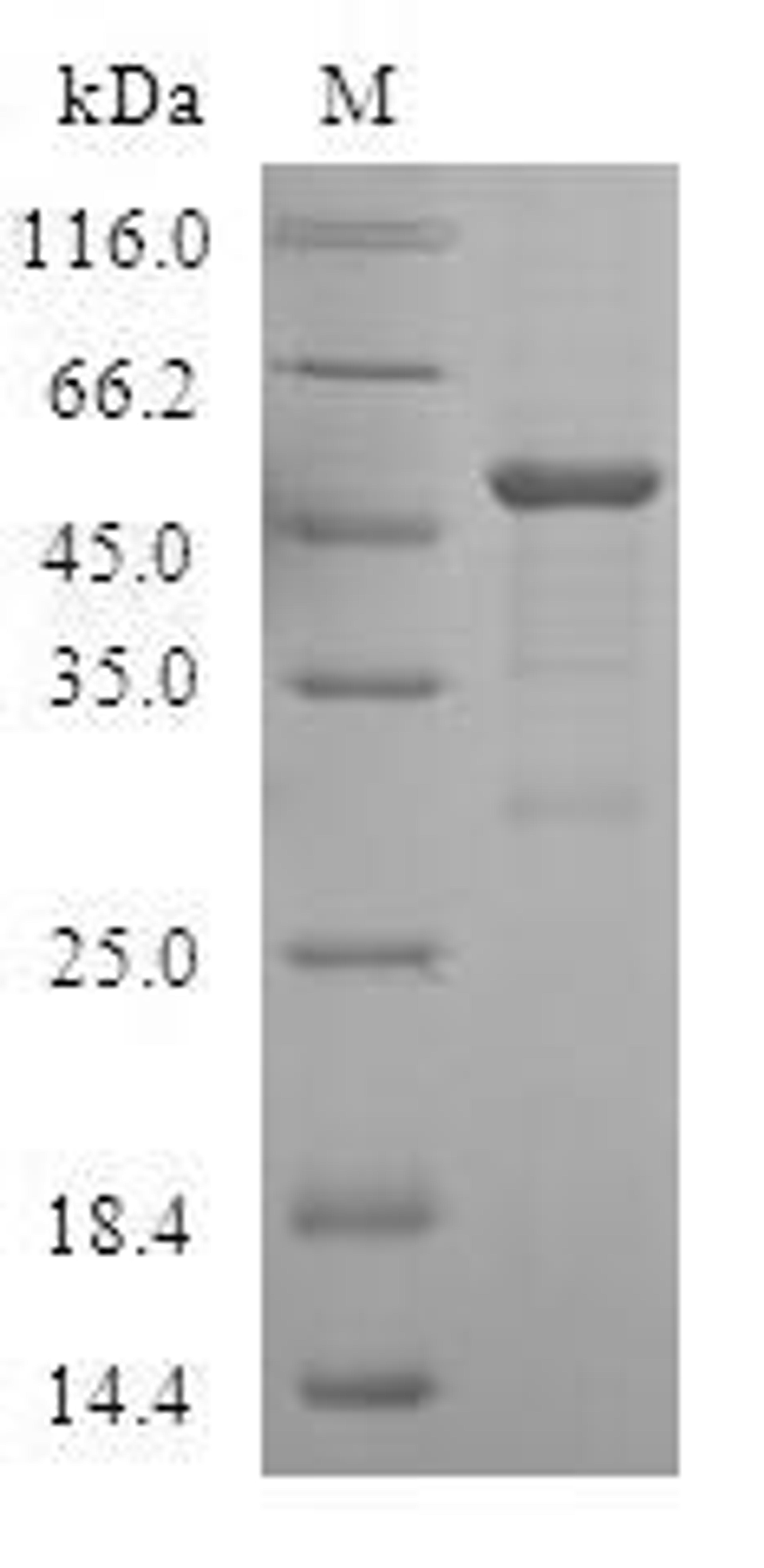 (Tris-Glycine gel) Discontinuous SDS-PAGE (reduced) with 5% enrichment gel and 15% separation gel.