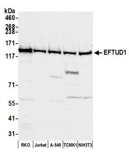 Detection of human and mouse EFTUD1 by WB.