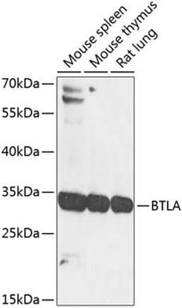 Western blot - BTLA antibody (A8377)