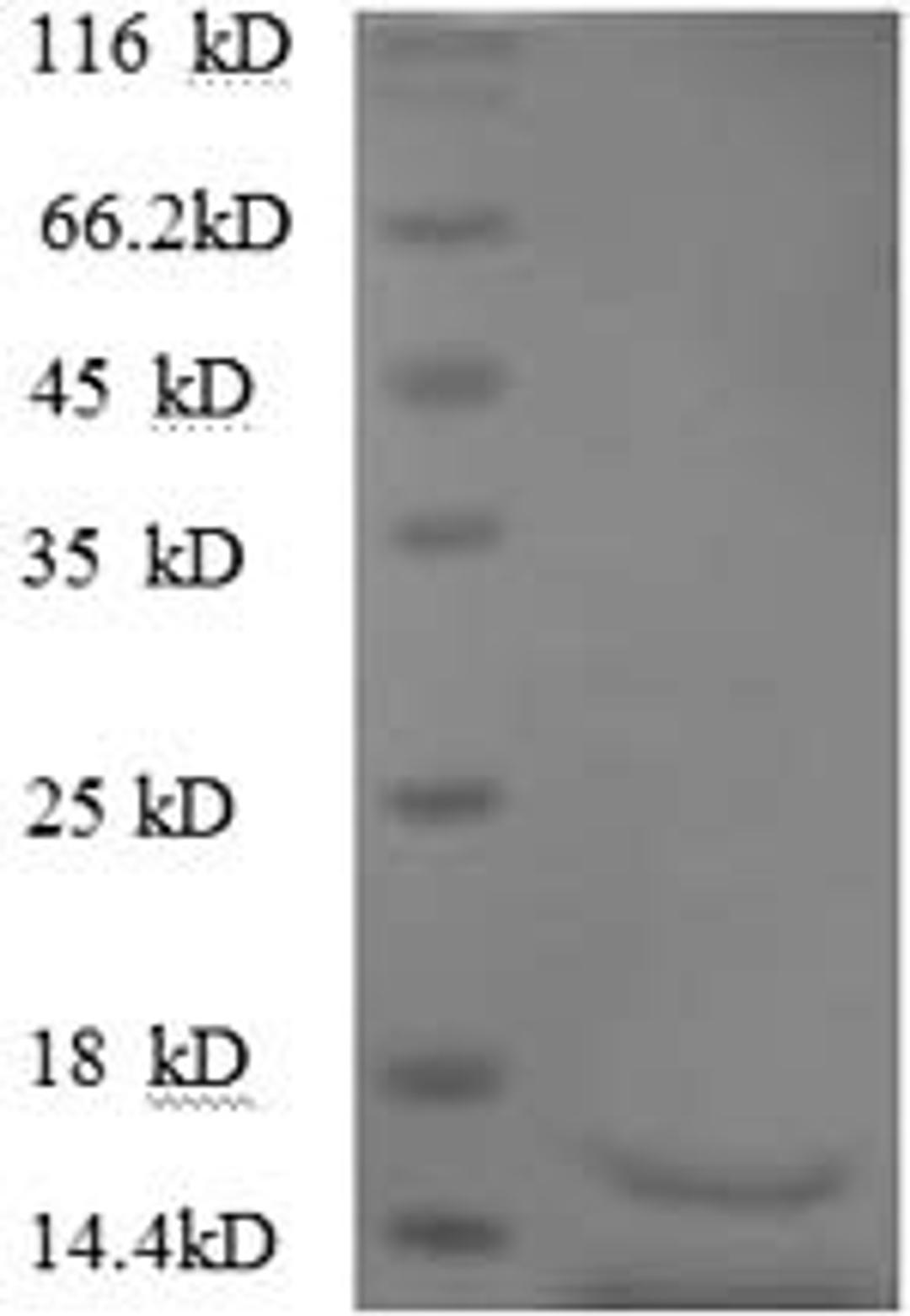 (Tris-Glycine gel) Discontinuous SDS-PAGE (reduced) with 5% enrichment gel and 15% separation gel.