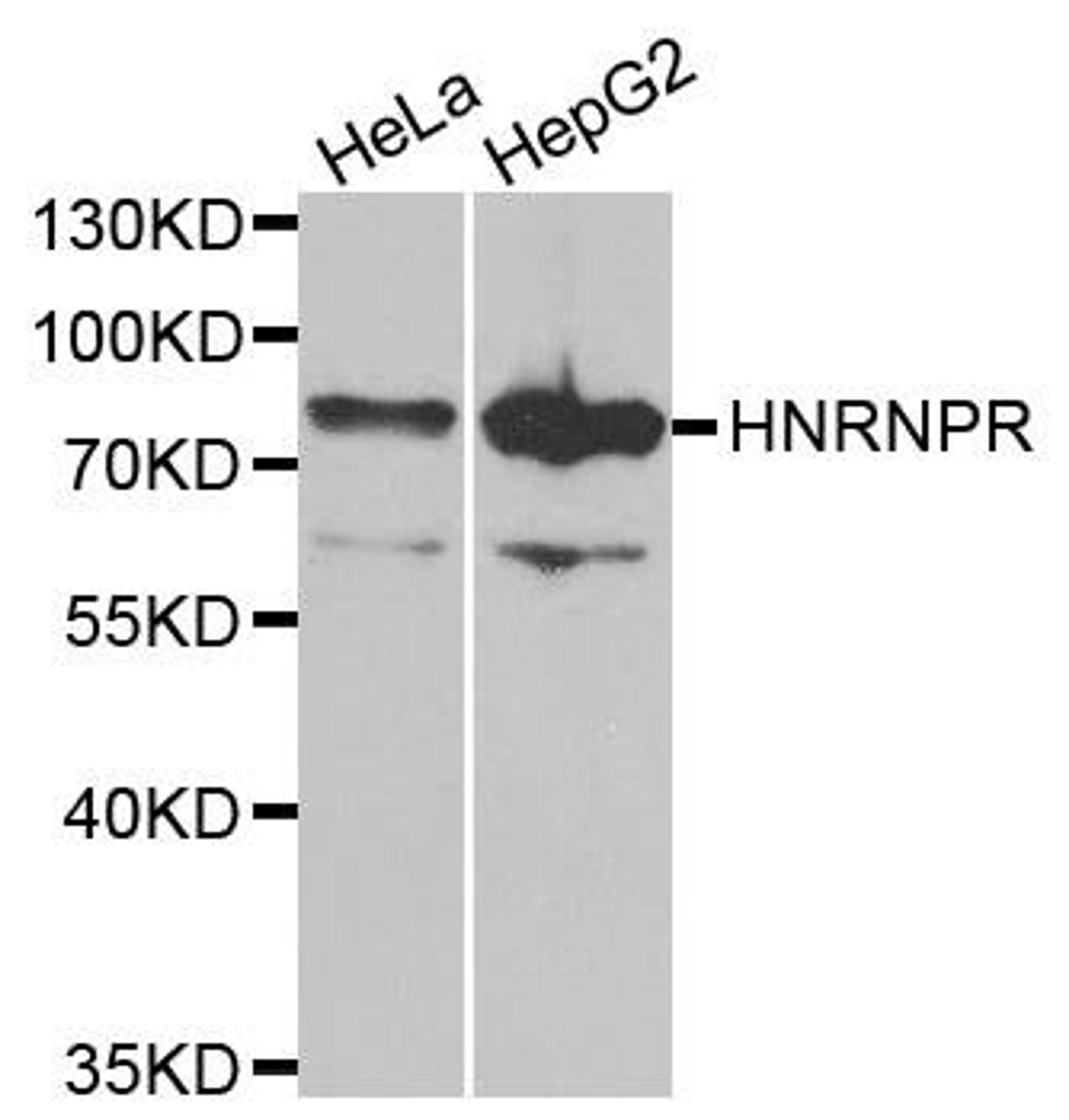 Western blot analysis of extracts of various cell lines using HNRNPR antibody