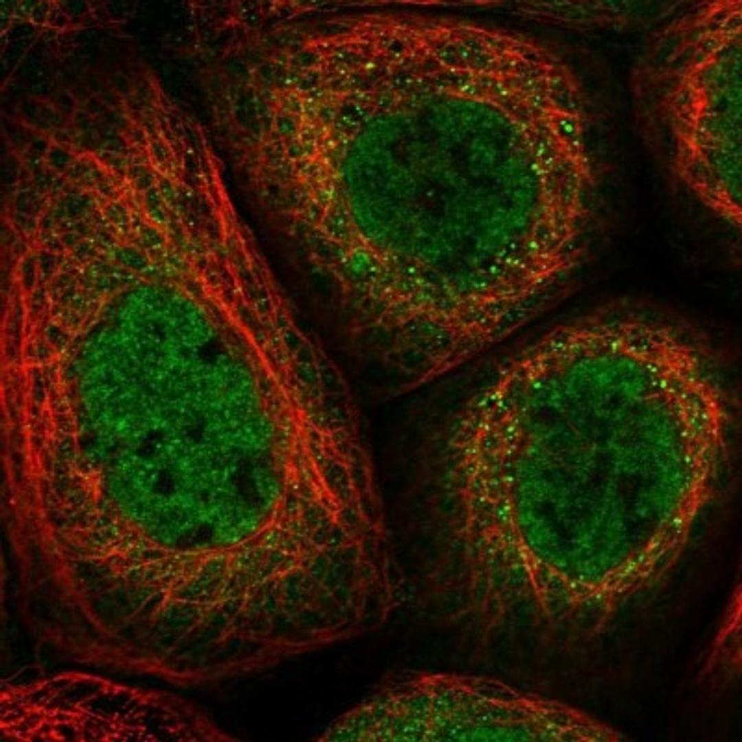 Immunocytochemistry/Immunofluorescence: TTC31 Antibody [NBP1-82282] - Staining of human cell line A-431 shows positivity in nucleus but not nucleoli & cytoplasm.