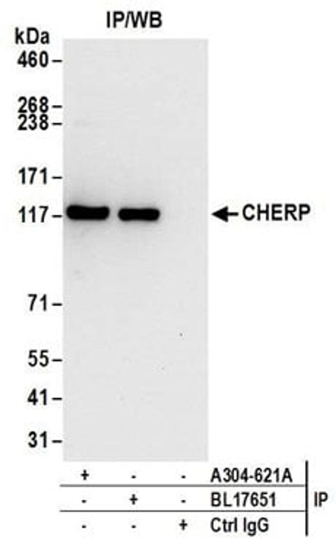 Detection of human CHERP by western blot of immunoprecipitates.