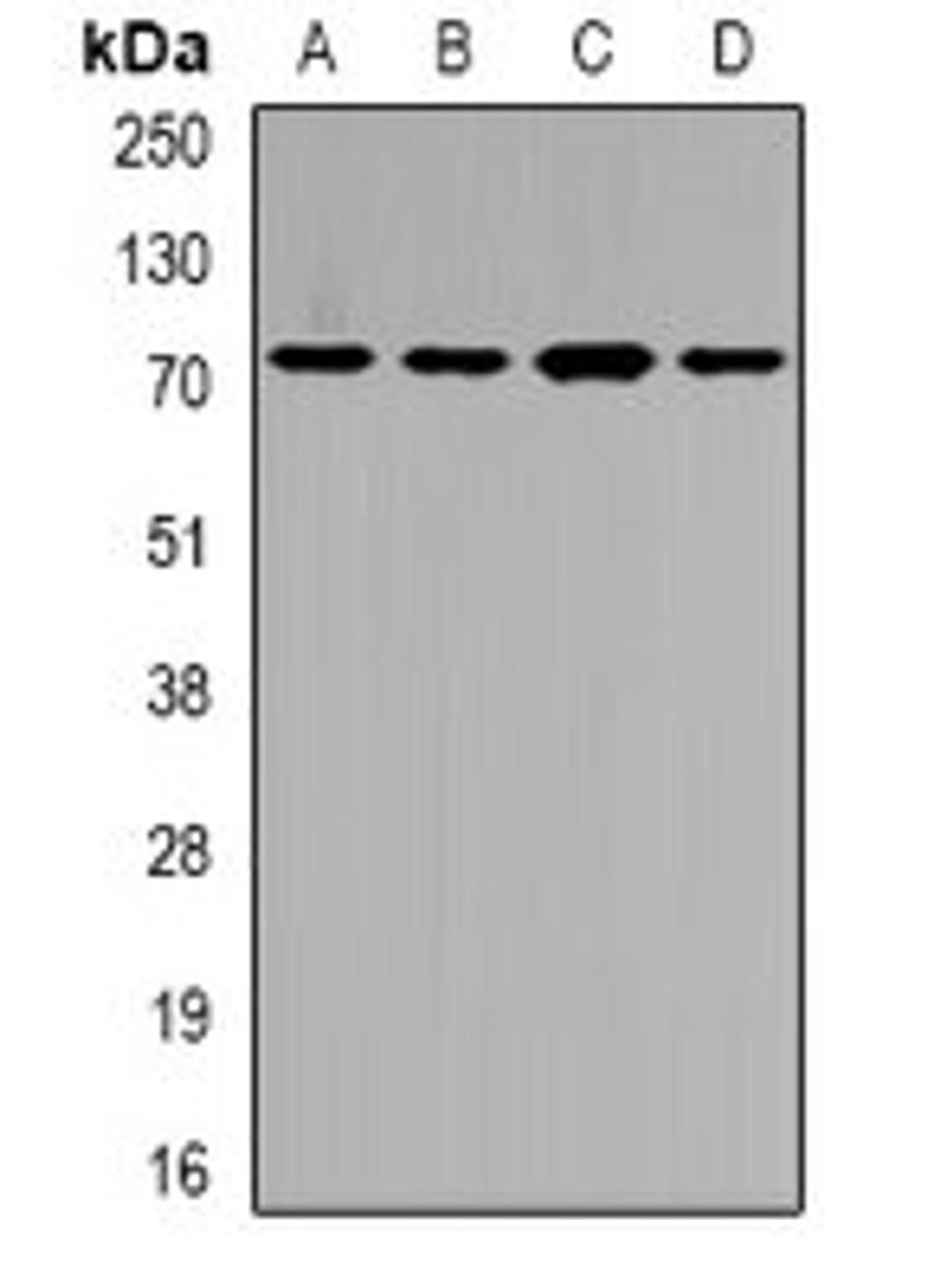 Western blot analysis of SW620 (Lane1), HepG2 (Lane2), mouse liver (Lane3), rat kidney (Lane4) whole cell lysates using SLC22A11 antibody