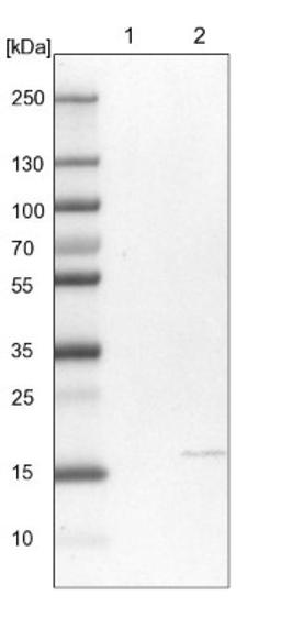 Western Blot: NDUFA8 Antibody [NBP1-82662] - Lane 1: NIH-3T3 cell lysate (Mouse embryonic fibroblast cells)<br/>Lane 2: NBT-II cell lysate (Rat Wistar bladder tumour cells)