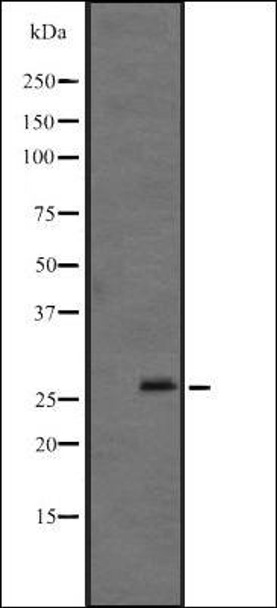 Western blot analysis of Mouse brain lysate using FGF12 antibody