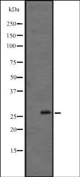 Western blot analysis of Mouse brain lysate using FGF12 antibody