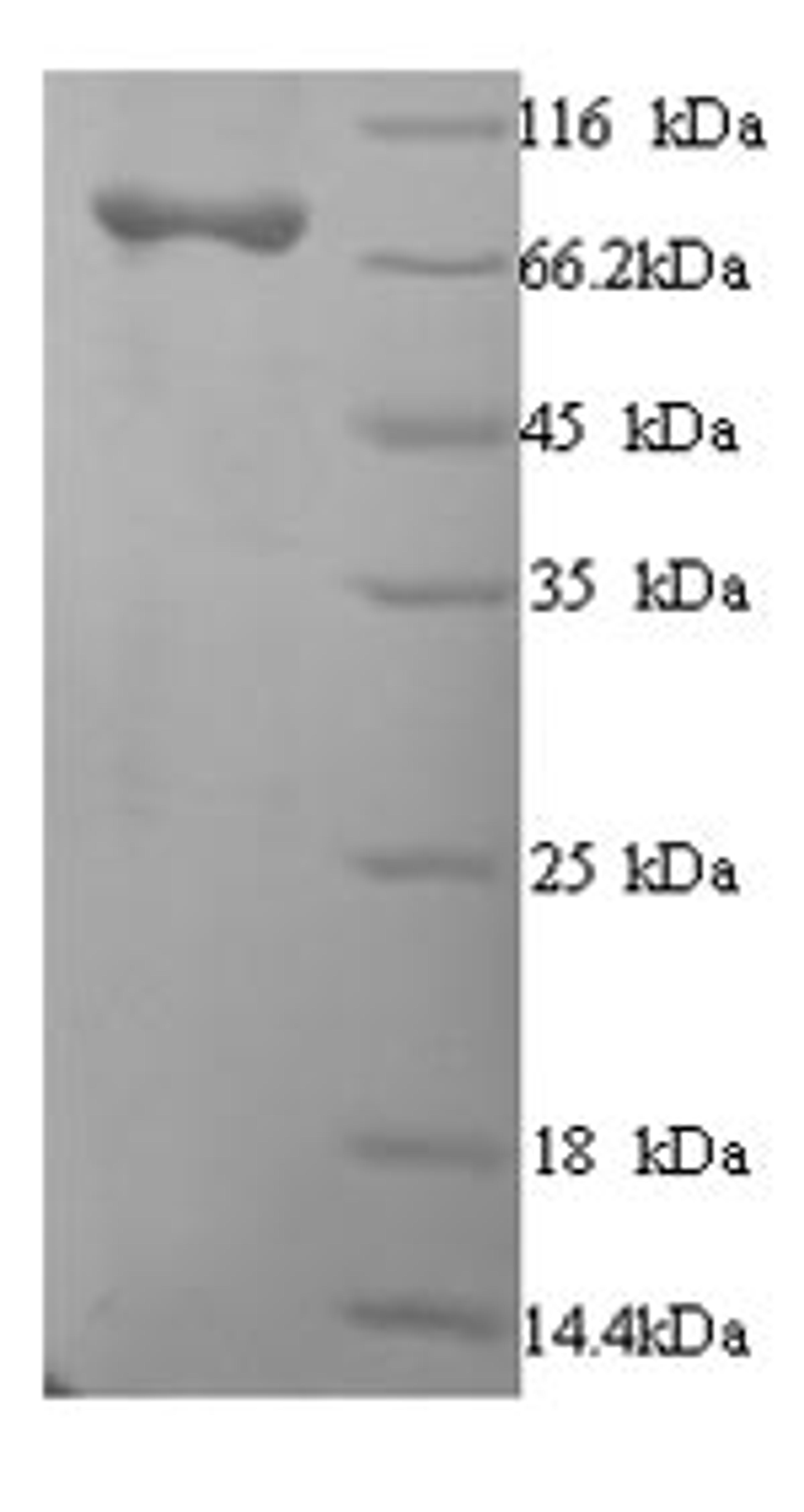 (Tris-Glycine gel) Discontinuous SDS-PAGE (reduced) with 5% enrichment gel and 15% separation gel.