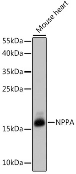 Western blot - NPPA antibody (A14755)