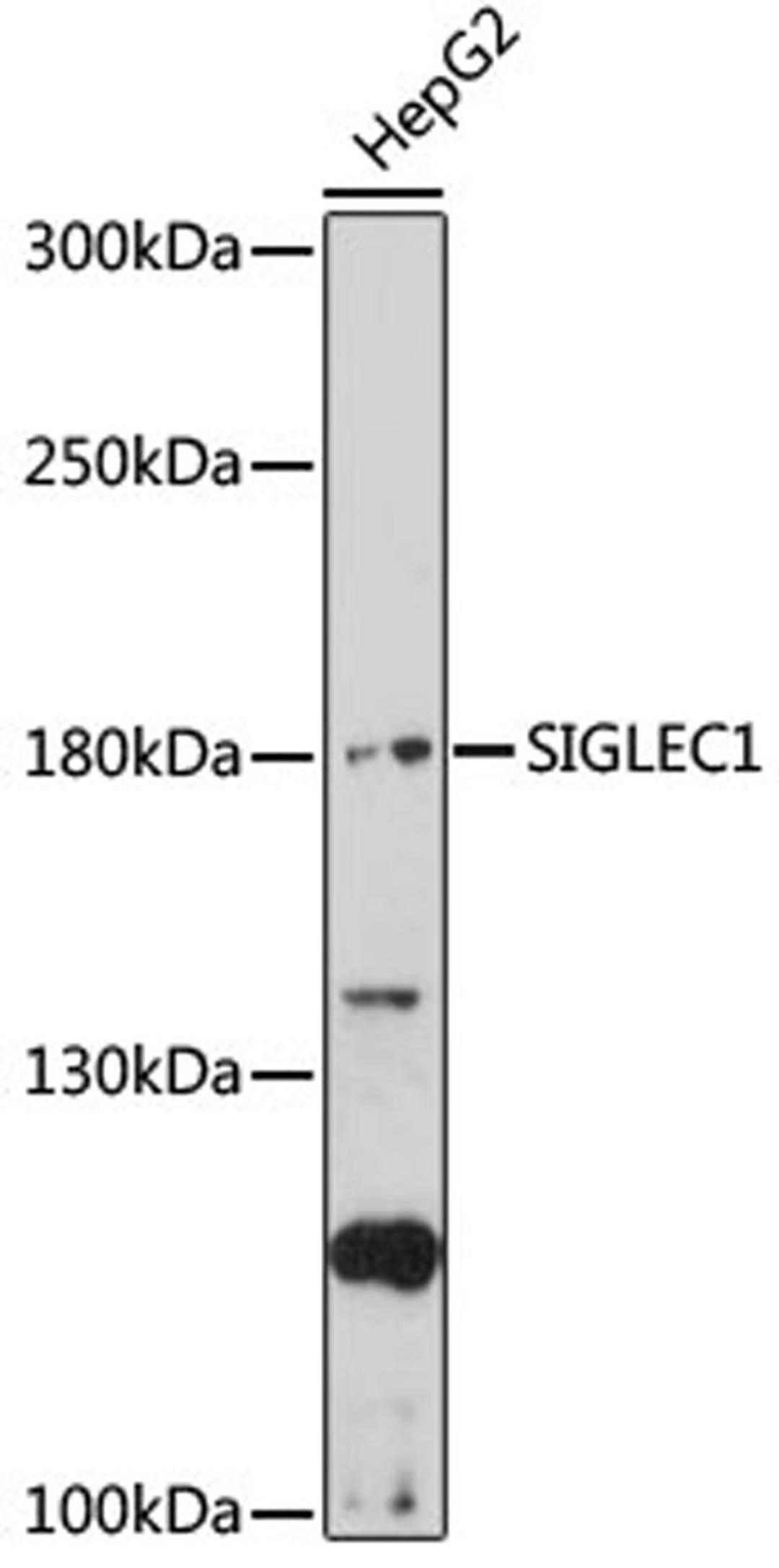 Western blot - SIGLEC1 antibody (A17533)