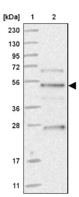 Western Blot: ZDHHC9 Antibody [NBP1-84499] - Lane 1: Marker [kDa] 230, 130, 95, 72, 56, 36, 28, 17, 11<br/>Lane 2: Human cell line RT-4