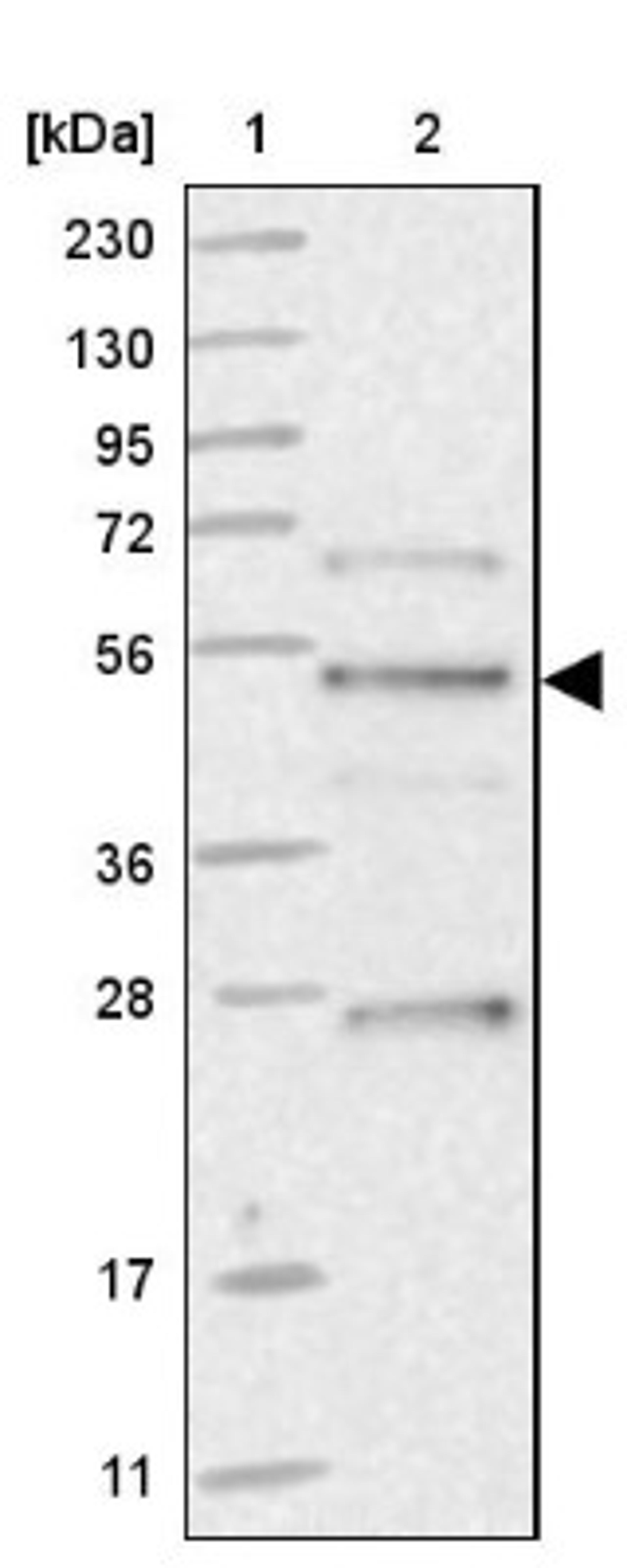 Western Blot: ZDHHC9 Antibody [NBP1-84499] - Lane 1: Marker [kDa] 230, 130, 95, 72, 56, 36, 28, 17, 11<br/>Lane 2: Human cell line RT-4