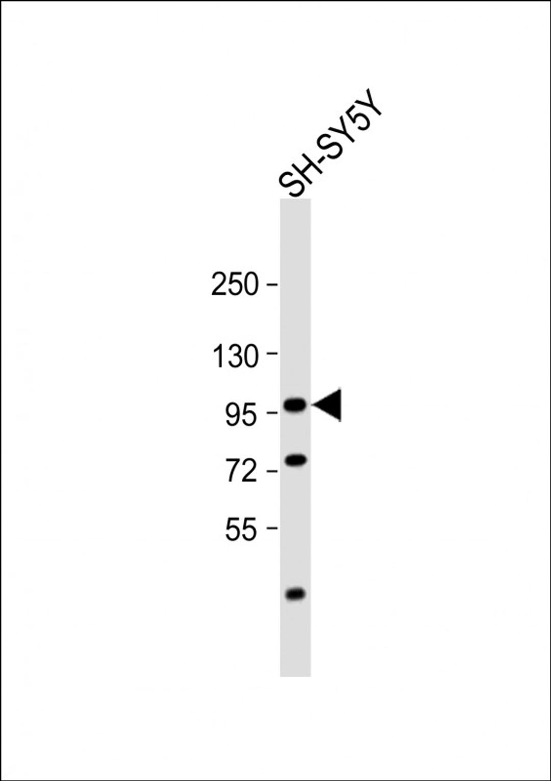 Western Blot at 1:1000 dilution + SH-SY5Y whole cell lysate Lysates/proteins at 20 ug per lane.