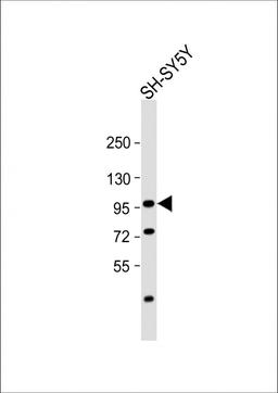 Western Blot at 1:1000 dilution + SH-SY5Y whole cell lysate Lysates/proteins at 20 ug per lane.