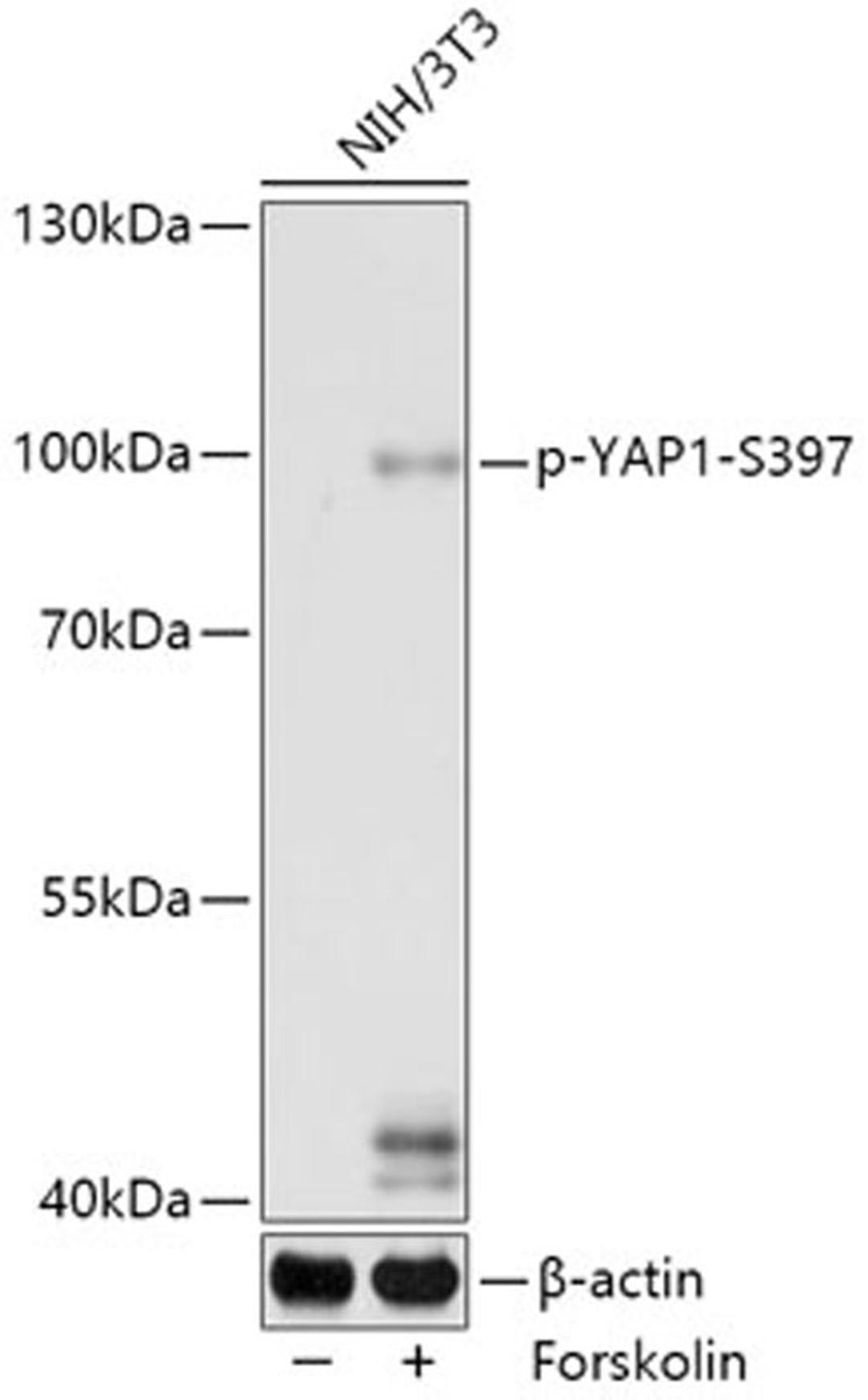 Western blot - phospho-YAP1-S397 antibody (AP0922)