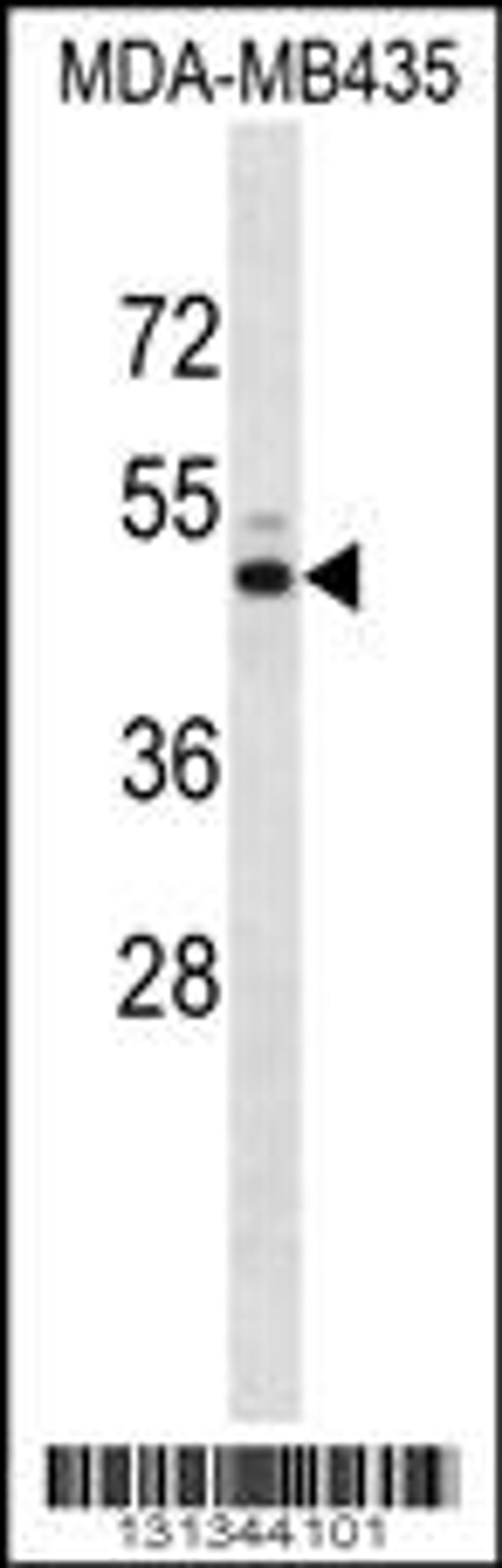 Western blot analysis in MDA-MB435 cell line lysates (35ug/lane).