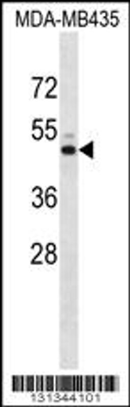 Western blot analysis in MDA-MB435 cell line lysates (35ug/lane).