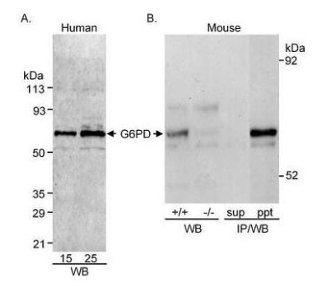 Western Blot: Glucose 6 Phosphate Dehydrogenase Antibody [NB100-236] - Detection of Human and Mouse G6PD by Western Blot and Immunoprecipitation.  Samples: Whole cell lysate (15 or 25 mcg for human; 20 mcg for mouse WB; 1 mg for mouse IP/WB) from human umbilical vein endothelial cells or mouse peritoneal macrophages from wildtype or G6PD deficient mice.  Antibody:  Affinity purified rabbit anti-G6PD used at 0.6 mcg/ml (A) and 0.5 mcg/ml (B) for WB or 3.75 mcg/mg lysate for IP (B).  Detection: Chemiluminescence.