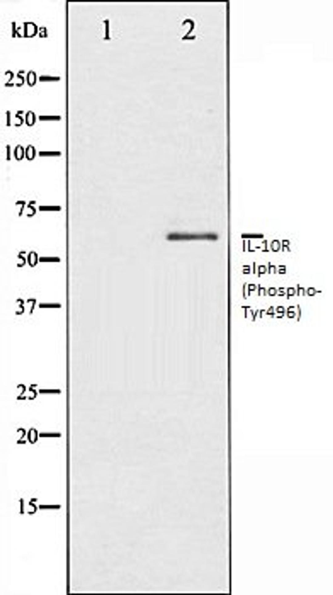 Western blot analysis of HuvEc whole cell lysates using IL-10R alpha (Phospho-Tyr496) antibody, The lane on the left is treated with the antigen-specific peptide.