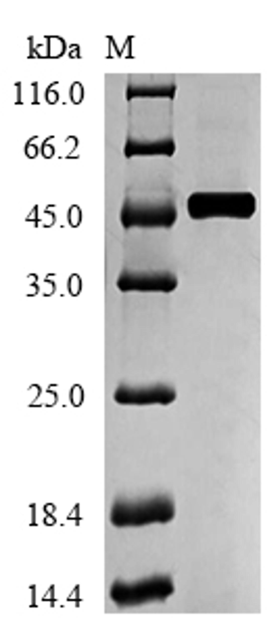 (Tris-Glycine gel) Discontinuous SDS-PAGE (reduced) with 5% enrichment gel and 15% separation gel.