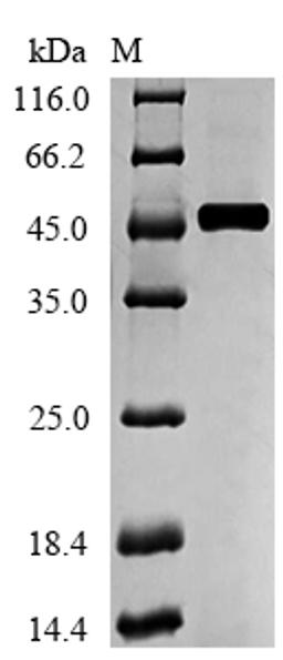 (Tris-Glycine gel) Discontinuous SDS-PAGE (reduced) with 5% enrichment gel and 15% separation gel.