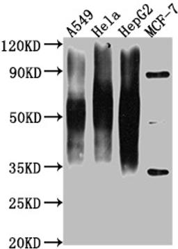 Western Blot. Positive WB detected in: A549 whole cell lysate, Hela whole cell lysate, HepG2 whole cell lysate, MCF-7 whole cell lysate . All lanes CD63 antibody at 1:1000. Secondary. Goat polyclonal to mouse IgG at 1/50000 dilution. Predicted band size: 30-120 KD KDa. Observed band size: 30-120 KD KDa. Exposure time:1min