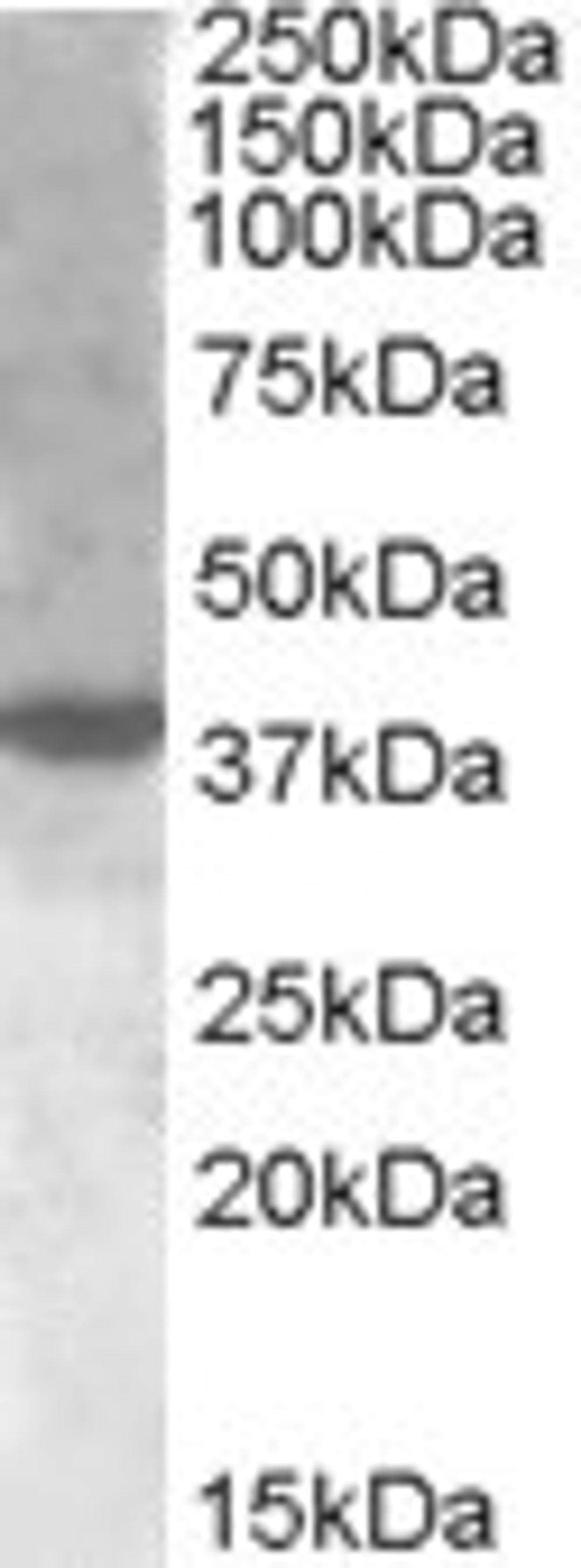 46-606 (1ug/ml) staining of nuclear HeLa lysate (35ug protein in RIPA buffer). Primary incubation was 1 hour. Detected by chemiluminescence.