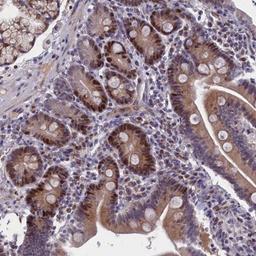 Immunohistochemistry: LIG1 Antibody [NBP2-32603] - Immunohistochemical staining of human duodenum shows distinct nuclear positivity in glandular cells.