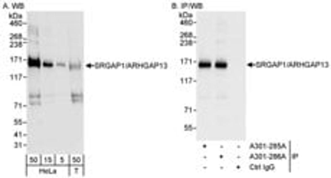 Detection of human SRGAP1/ARHGAP13 by western blot and immunoprecipitation.