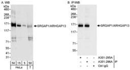 Detection of human SRGAP1/ARHGAP13 by western blot and immunoprecipitation.