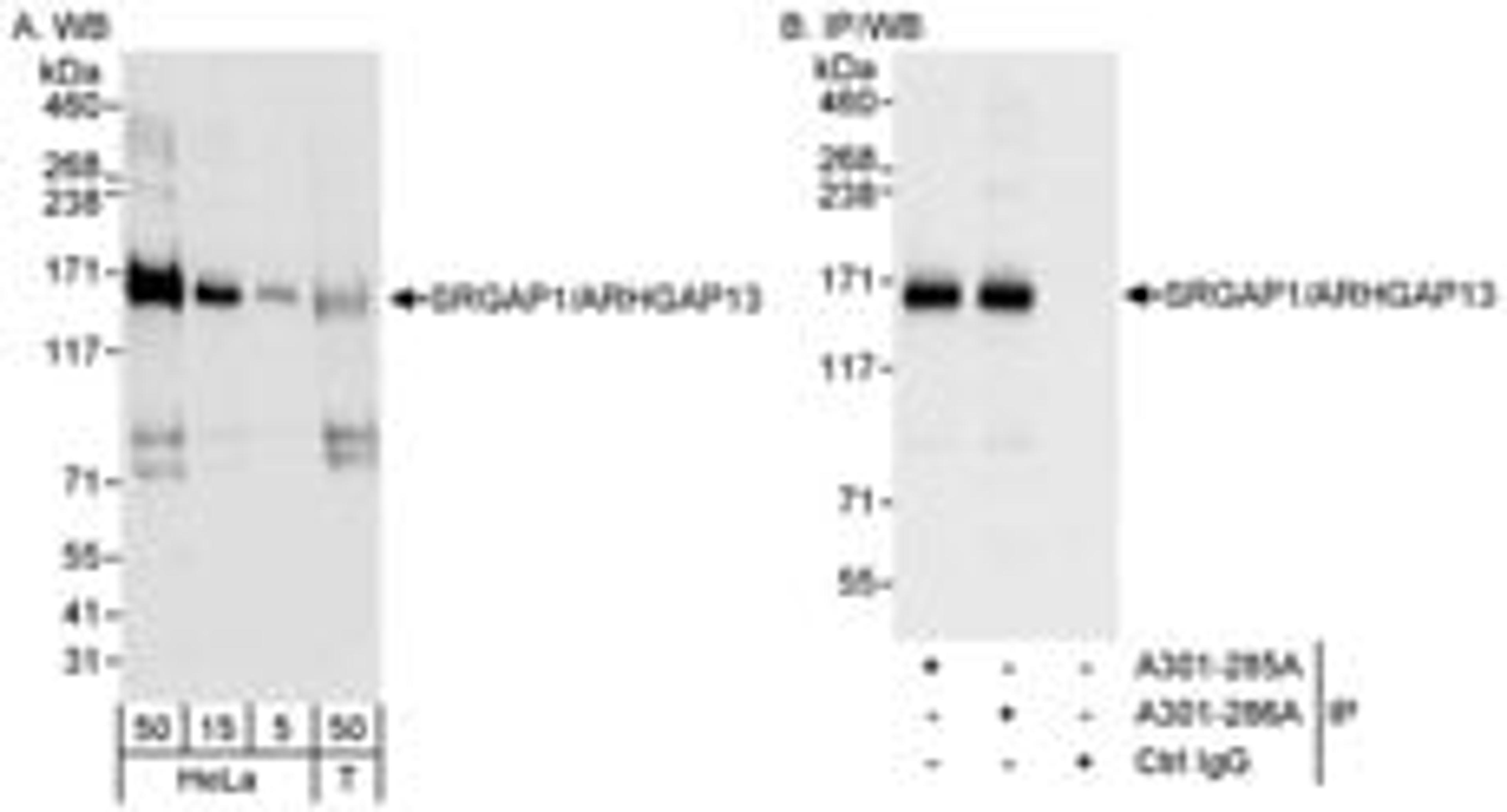 Detection of human SRGAP1/ARHGAP13 by western blot and immunoprecipitation.