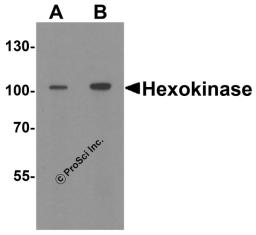 Western blot analysis of Hexokinase 1 in rat bladder tissue lysate with Hexokinase 1 antibody at (A) 1 and (B) 2 &#956;g/ml.