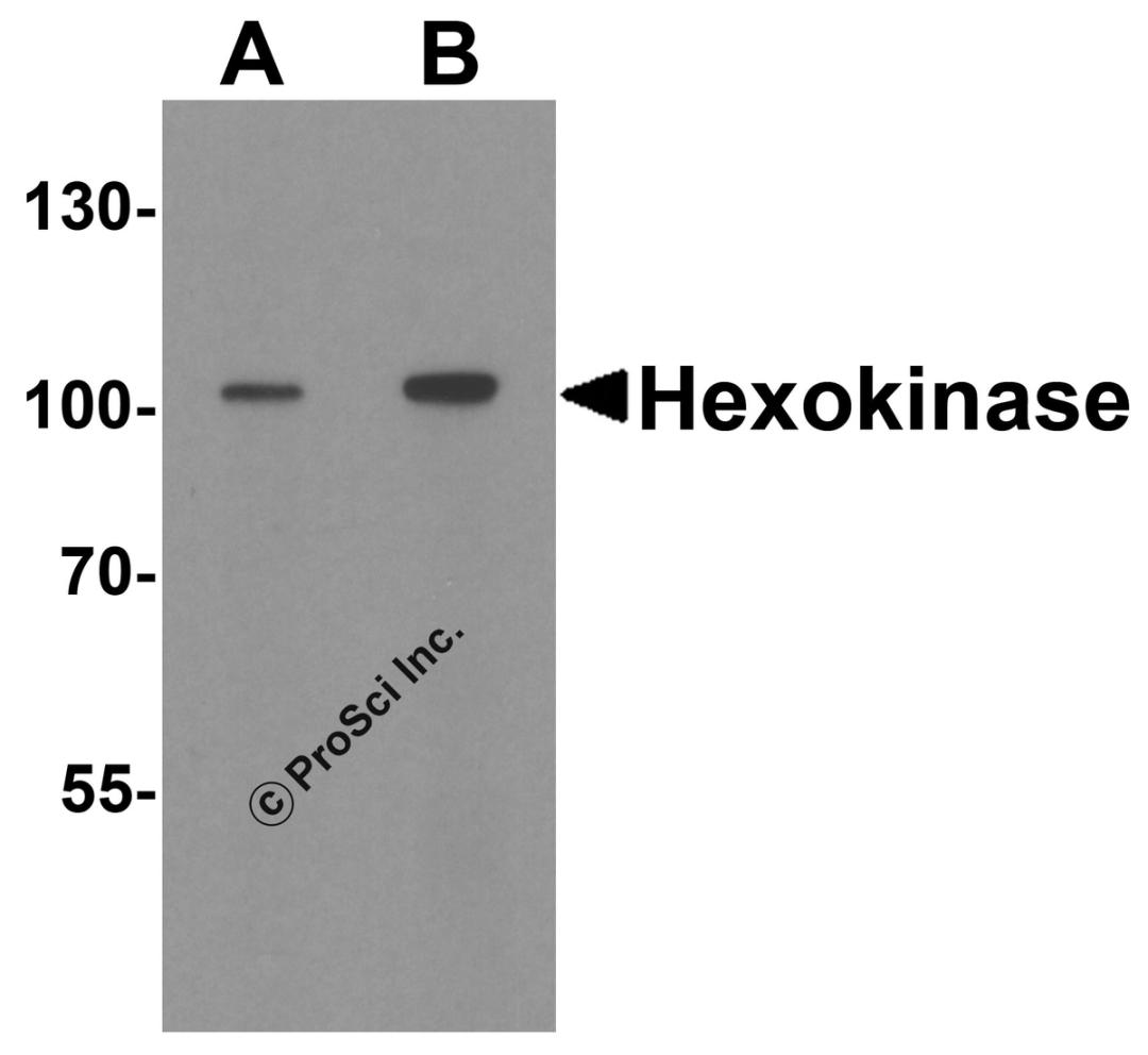 Western blot analysis of Hexokinase 1 in rat bladder tissue lysate with Hexokinase 1 antibody at (A) 1 and (B) 2 μg/ml.