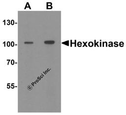 Western blot analysis of Hexokinase 1 in rat bladder tissue lysate with Hexokinase 1 antibody at (A) 1 and (B) 2 μg/ml.