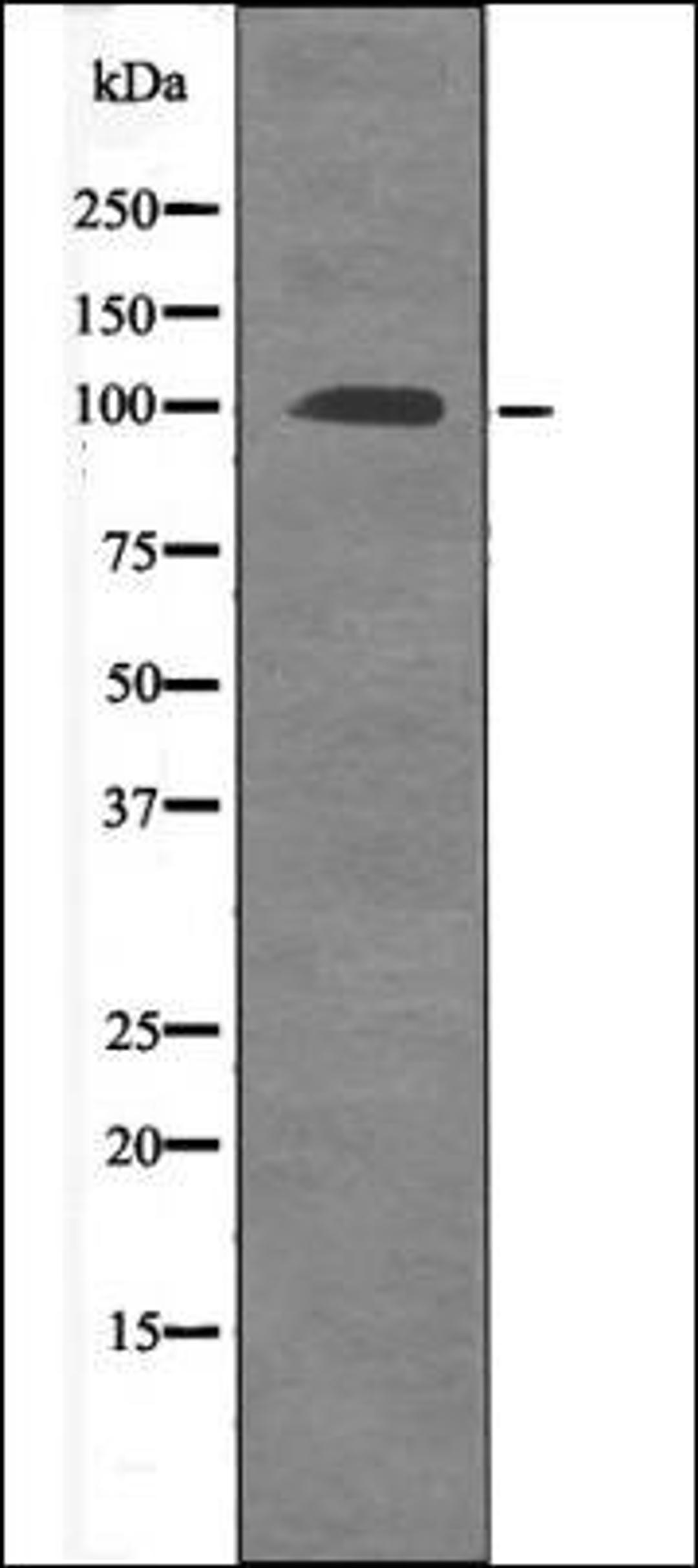 Western blot analysis of EGF treated 293 whole cell lysates using FKHRL1 -Phospho-Ser315- antibody