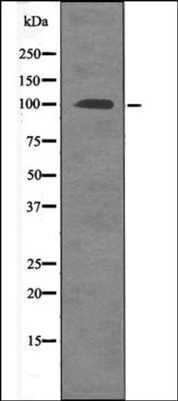 Western blot analysis of EGF treated 293 whole cell lysates using FKHRL1 -Phospho-Ser315- antibody