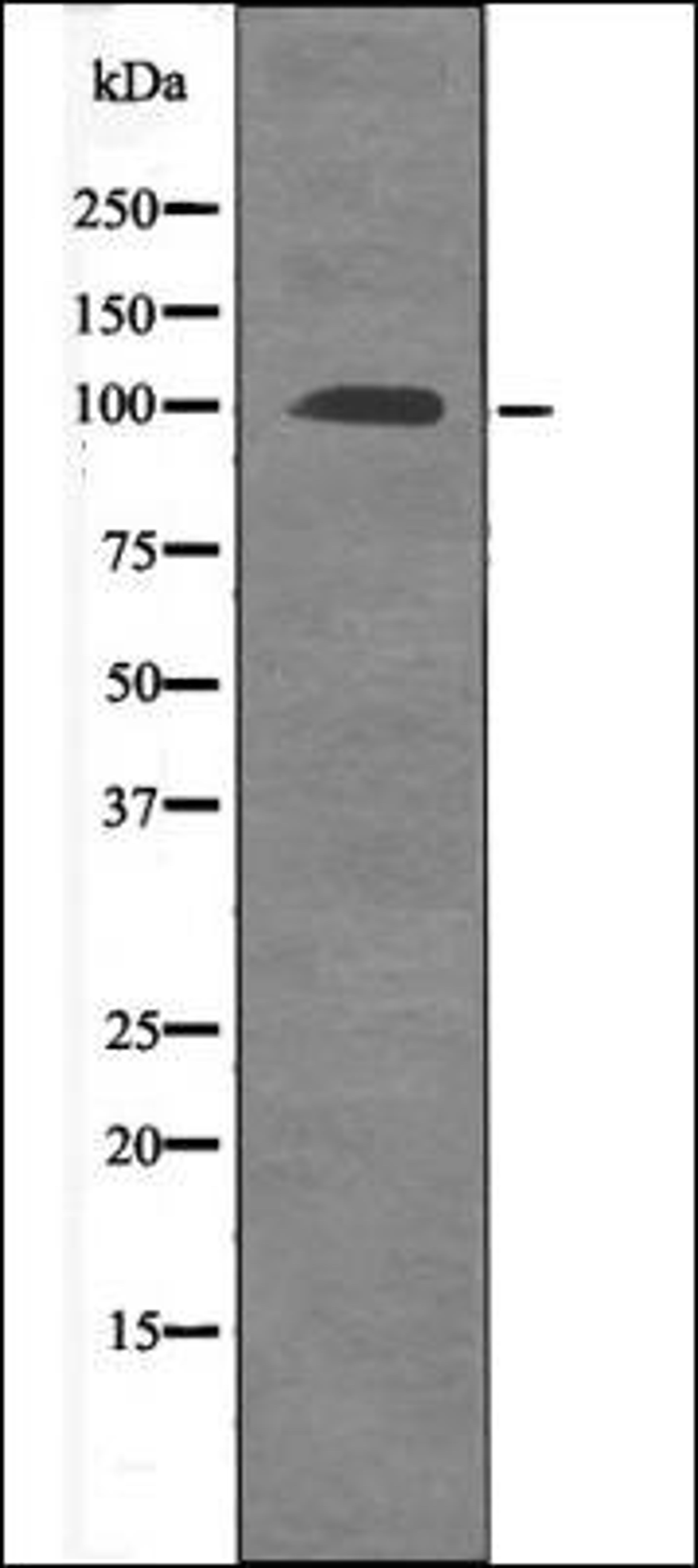 Western blot analysis of EGF treated 293 whole cell lysates using FKHRL1 -Phospho-Ser315- antibody