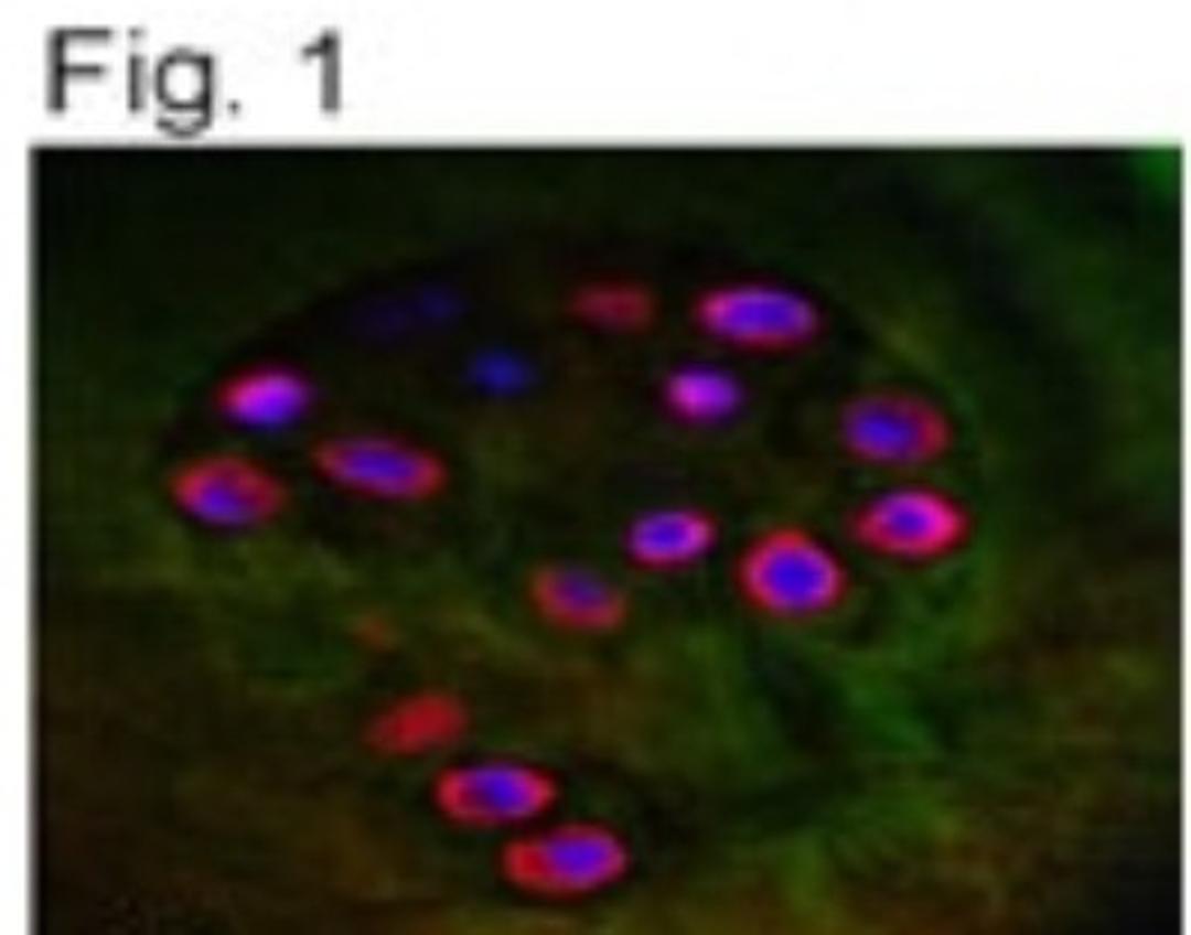 Immunocytochemistry/Immunofluorescence: Aggrecan Neoepitope Antibody [NB100-74350] - Detection of ACAN in OA cartilage using NB100-74350.