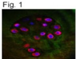 Immunocytochemistry/Immunofluorescence: Aggrecan Neoepitope Antibody [NB100-74350] - Detection of ACAN in OA cartilage using NB100-74350.