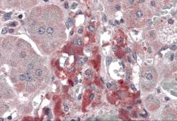 Immunohistochemistry of RIM2 in human adrenal gland tissue with RIM2 antibody at 5 &#956;g/mL.